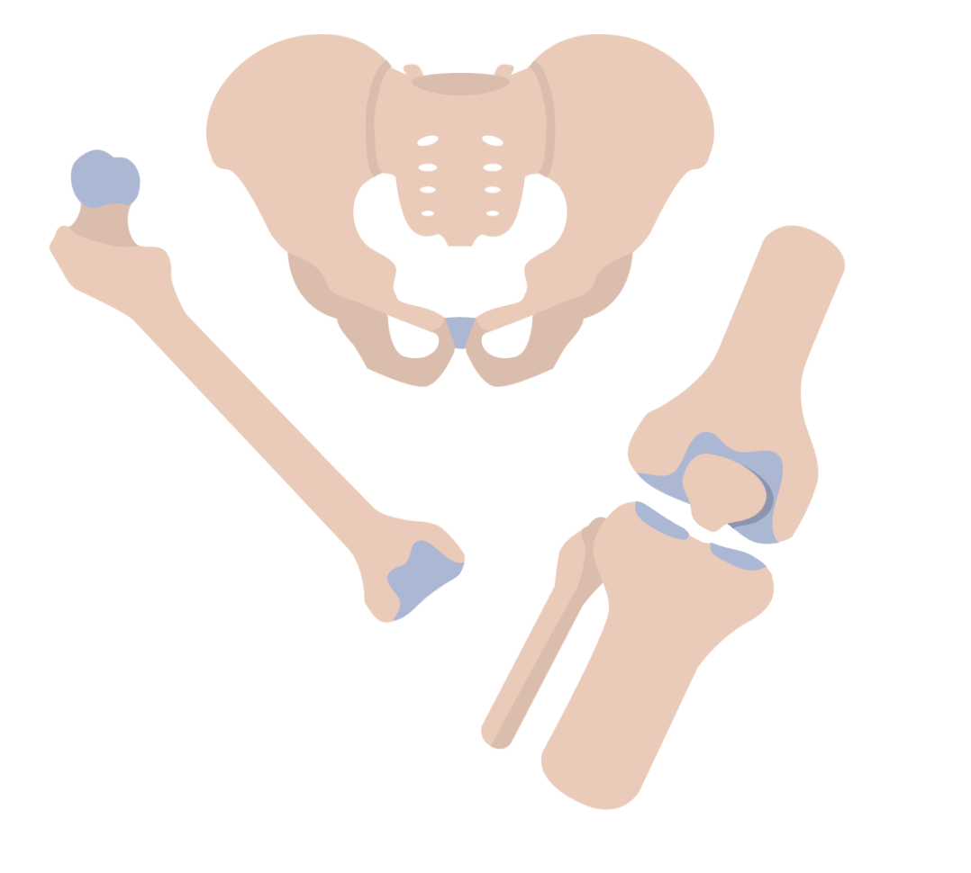 Hip & Knee Protocol