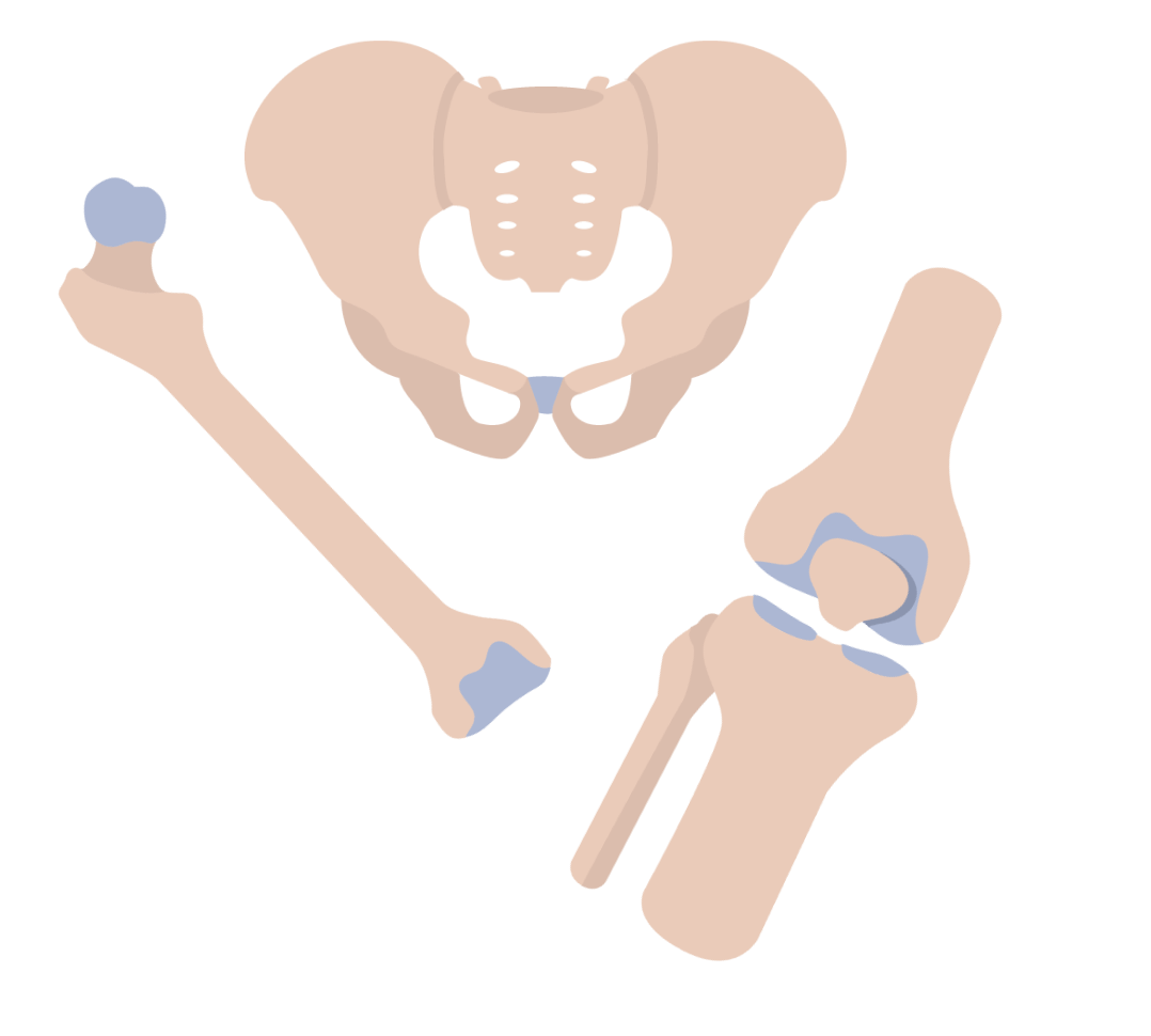 Illustration of Hip & Knee Arthroplasty Protocol